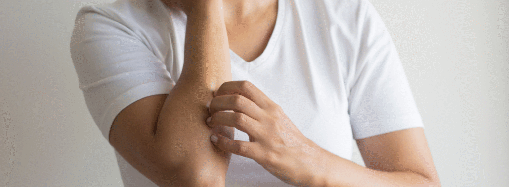 fibromialgia e pele sensivel
